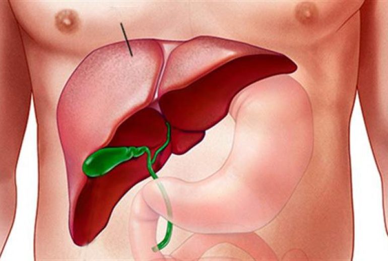 دکتر التهاب کیسه صفرا - بندرعباس