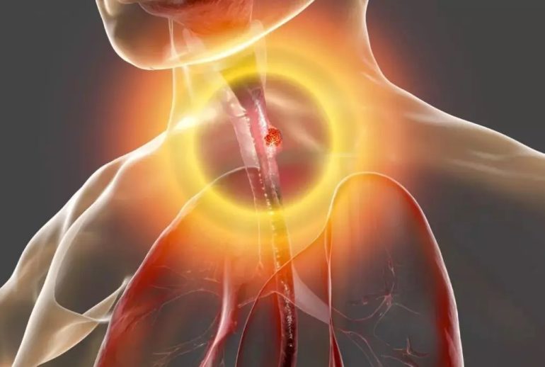 دکتر بیماری مری بارت - تهران