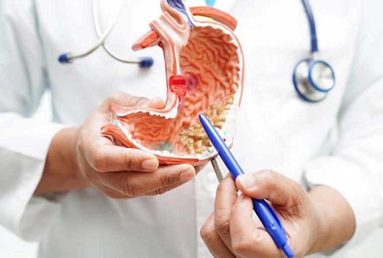 دکتر گاستريت (ورم معده) - کرج